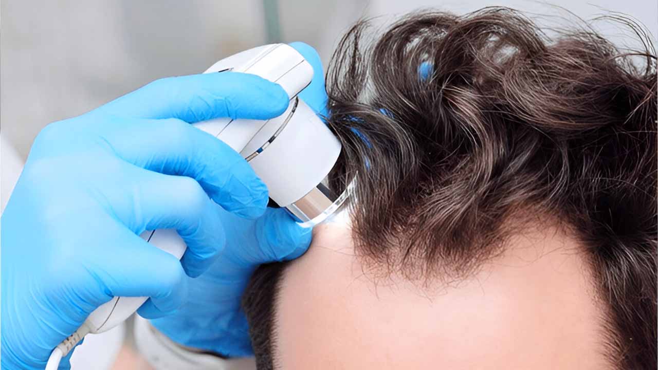 Trichoscopic Examination (Advance Scalp Imaging)