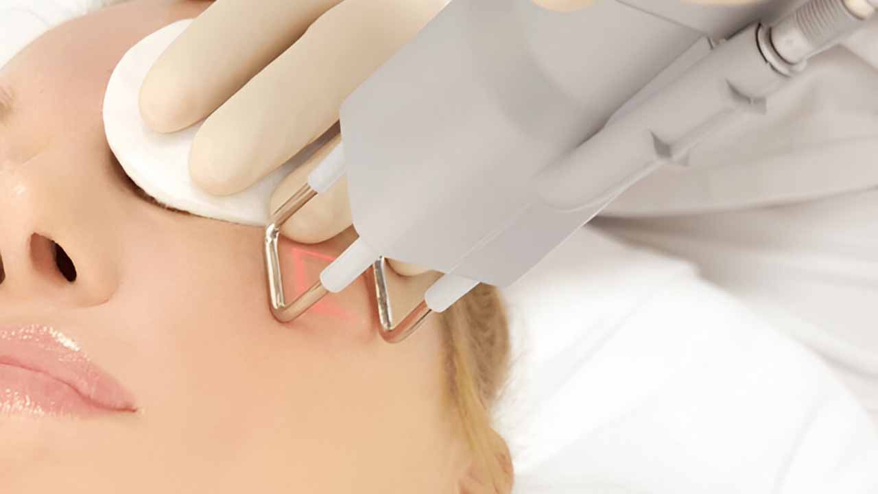 CO2 Lasers for Skin Resurfacing